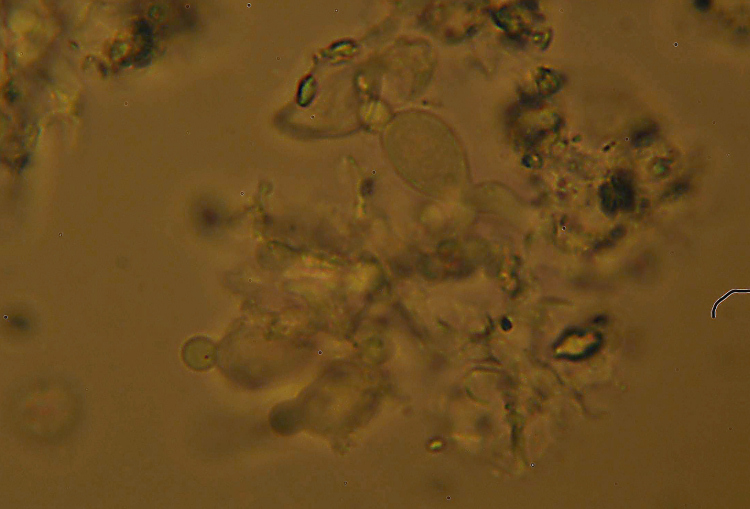 Crosta bianca da det. - foto 7006 (Crustomyces subabruptus)